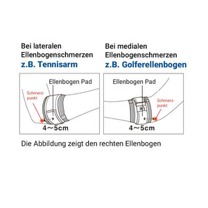Ellenbogen-Band